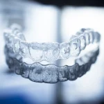 Aparat nakładkowy Invisalign Warszawa